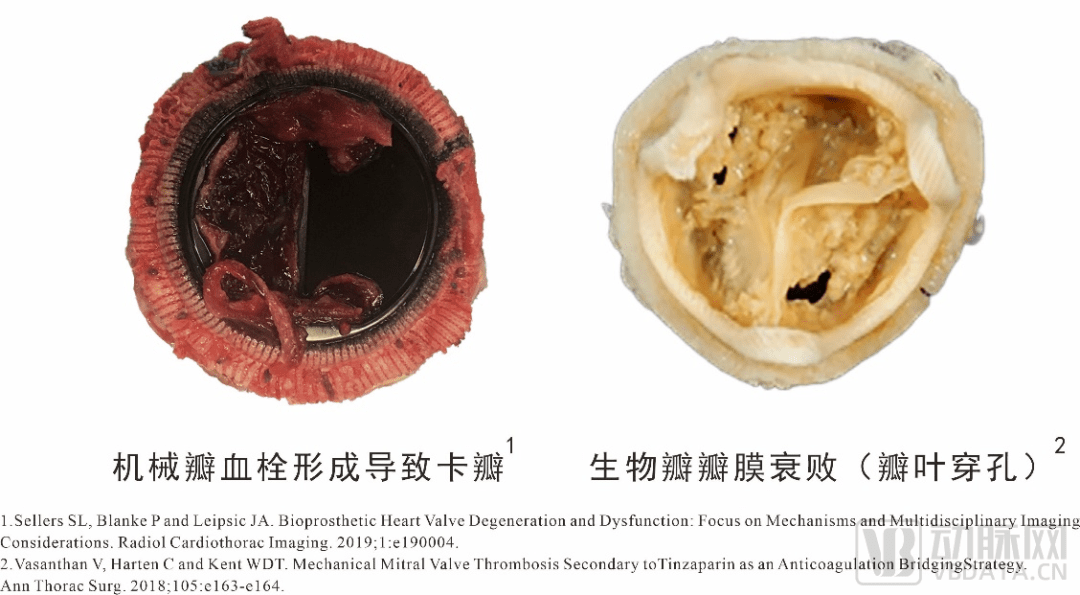 联影医疗与思努赛生物达成战略合作 携手推进帕金森病分子影像临床转化